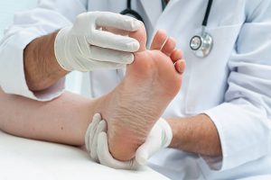 Μυκητιασική λοίμωξη στα πόδια – Συμπτώματα και θεραπεία