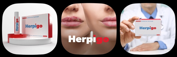 Τι είναι το Herpigo 